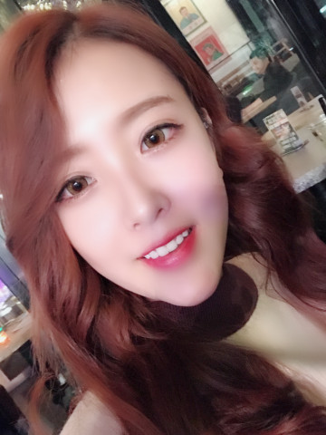 成都漢密爾頓牙齒矯正案例 成都漢密爾頓牙齒矯正案例