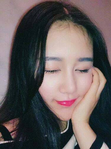 漢中韓美整形醫(yī)生常雙模假體隆鼻+耳軟骨墊鼻尖真實案例效果圖