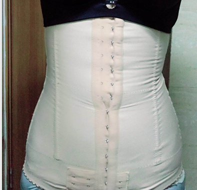 深圳晨曦整形醫(yī)院吉米斯做腰腹吸脂怎么樣？附吉米斯醫(yī)生腰腹吸脂案例