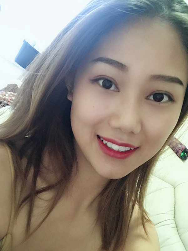 西安藝星埋線提升案例 西安藝星埋線提升案例