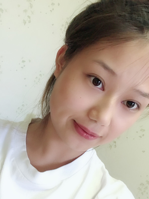 西安藝星整形醫(yī)院徐智慧醫(yī)生做埋線提升怎么樣？附西安藝星埋線提升案例