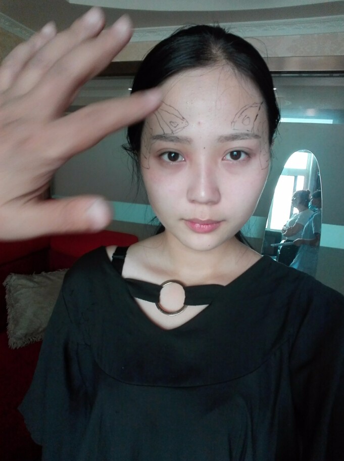 西安華仁醫(yī)院整形美容中心做自體脂肪填充效果怎么樣？附耿延鵬整形案例