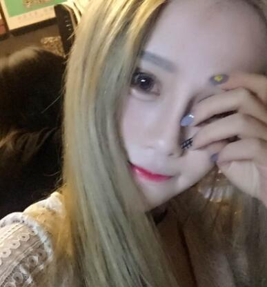 長春奧拉克美容醫(yī)院金相勛醫(yī)生做玻尿酸豐臥蠶怎么樣？附案例