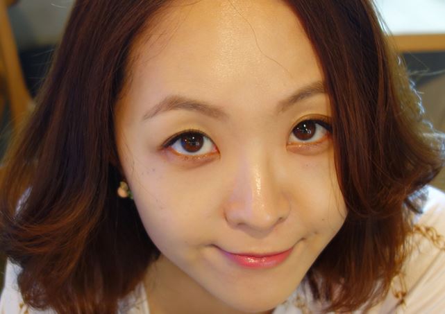 徐州時光洪揚醫(yī)療美容診所宮昔愿醫(yī)生做激光祛斑效果怎么樣？