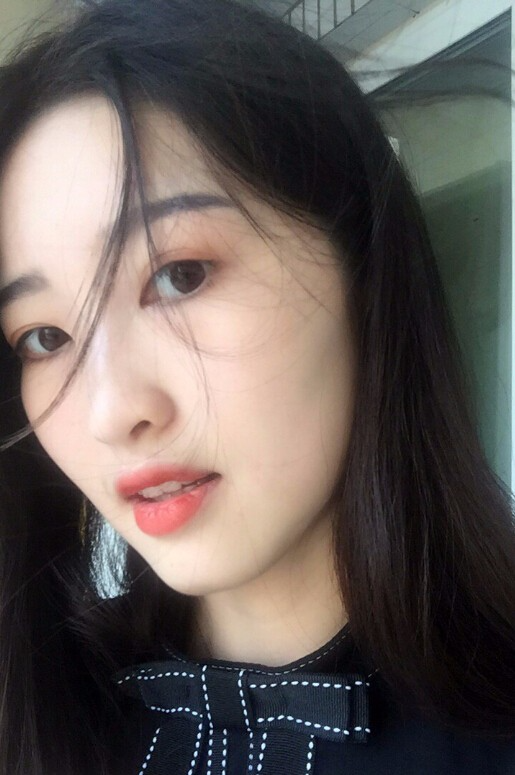 鄭州正合口腔門診部做牙齒矯正怎么樣？附郭毅醫(yī)生牙齒金屬托槽矯正案例