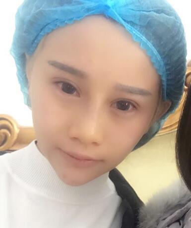 長春奧拉克美容醫(yī)院金相勛醫(yī)生做玻尿酸豐臥蠶怎么樣？附案例