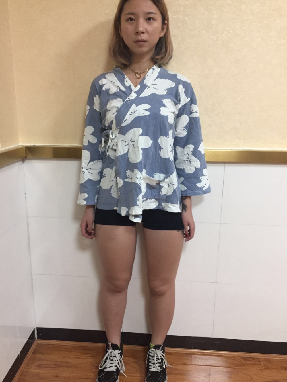 深圳鵬愛醫(yī)療整形醫(yī)生張建文做大腿吸脂怎么樣？附大腿吸脂案例效果對比圖