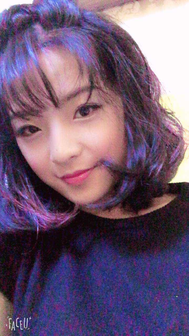 鄭州名門整形醫(yī)院董斌醫(yī)生做下頜角整形怎么樣？附下頜角整形案例