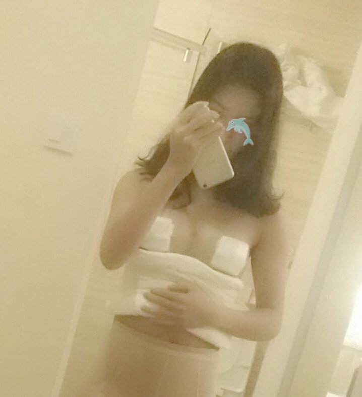 天津怡麗亞韓整形醫(yī)院林海峰醫(yī)生做自體脂肪隆胸真實案例效果對比圖 天津怡麗亞韓整形醫(yī)院林海峰醫(yī)生做自體脂肪隆胸真實案例效果對比圖