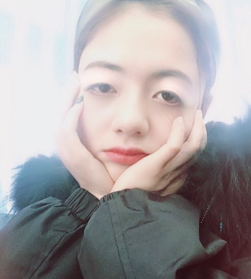 珠海平安康復醫(yī)院整形美容中心查元坤醫(yī)生面部吸脂案例效果對比圖 珠海平安康復醫(yī)院整形美容中心查元坤醫(yī)生面部吸脂案例效果對比圖