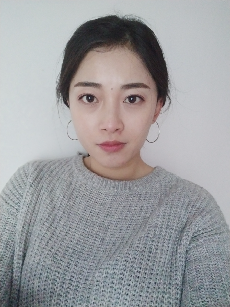 重慶當(dāng)代整形李敏旭醫(yī)生做皮秒激光祛斑效果怎么樣？附皮秒激光祛斑案例