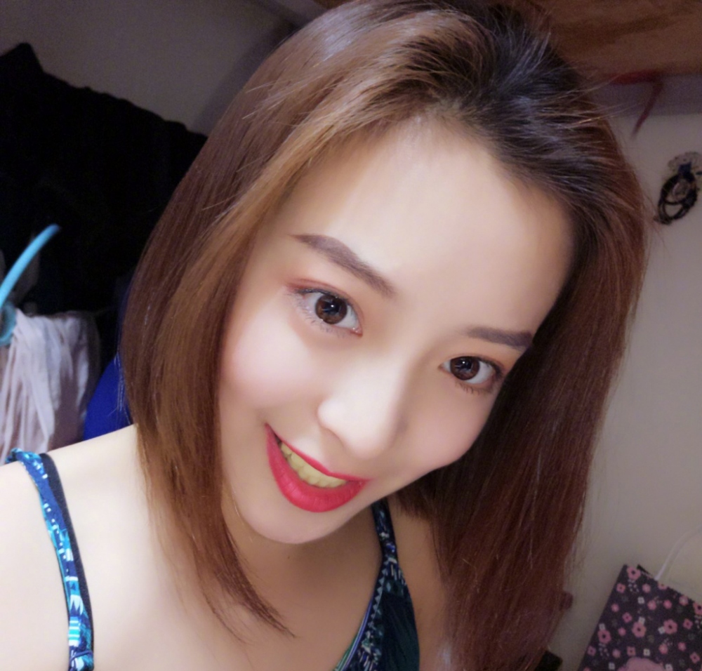 重慶樂樂欣口腔趙麗麗醫(yī)生做冷光美白效果怎么樣？附冷光美白效果對比圖