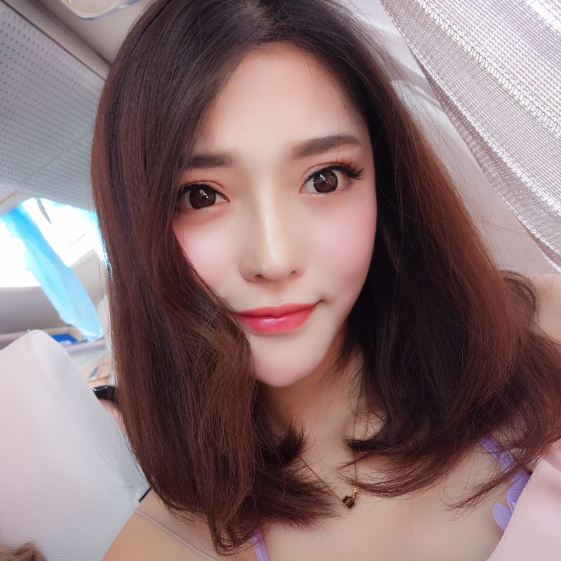 鄭州童一顏整形醫(yī)生李永勝做假體隆鼻+耳軟骨隆鼻案例效果對比圖 鄭州童一顏整形醫(yī)生李永勝做假體隆鼻+耳軟骨隆鼻案例效果對比圖