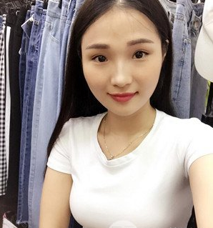 珠海萊茵醫(yī)療美容醫(yī)院崔俊溶醫(yī)生做自體脂肪隆胸效果怎么樣？附自體脂肪隆胸案例