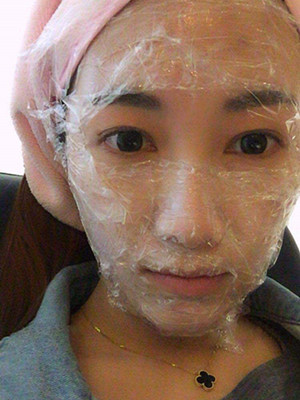 重慶五洲女子醫(yī)院整形美容中心做光子嫩膚怎么樣？淡明斌醫(yī)生光子嫩膚案例