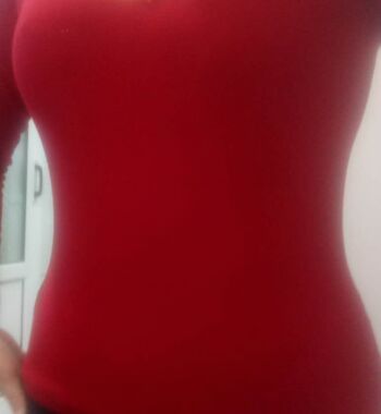 武漢東方麗人醫(yī)院整形美容科胡江偉醫(yī)生做腰腹吸脂案例效果對(duì)比圖 武漢東方麗人醫(yī)院整形美容科胡江偉醫(yī)生做腰腹吸脂案例效果對(duì)比圖