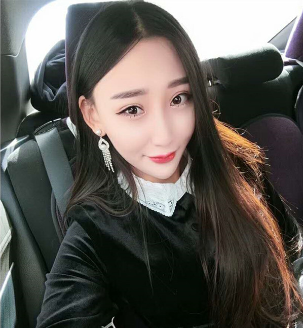 武漢中翰整形外科醫(yī)院沈磊醫(yī)生做切開(kāi)雙眼皮怎么樣？附沈磊切開(kāi)雙眼皮案例