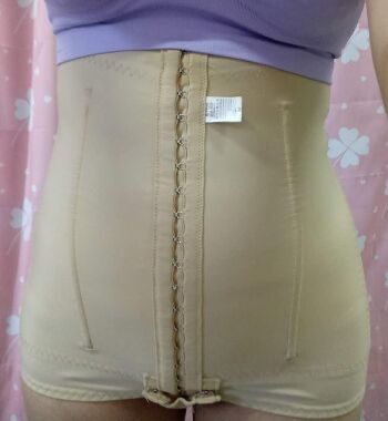 武漢東方麗人醫(yī)院整形美容科胡江偉醫(yī)生做腰腹吸脂案例效果對(duì)比圖 武漢東方麗人醫(yī)院整形美容科胡江偉醫(yī)生做腰腹吸脂案例效果對(duì)比圖