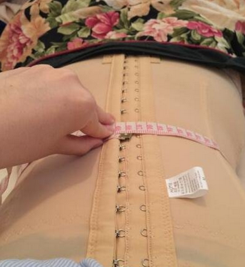 成都蜀尚蓉雅整形醫(yī)生張知華做腰腹吸脂效果怎么樣？附腰腹吸脂案例