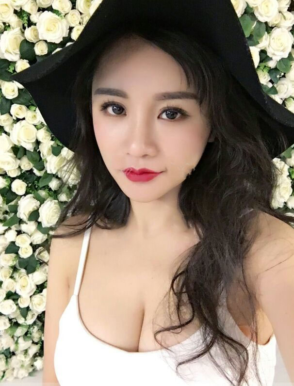 海南韓美醫(yī)學(xué)美容醫(yī)院李強醫(yī)生做自體脂肪隆胸效果怎么樣？附案例