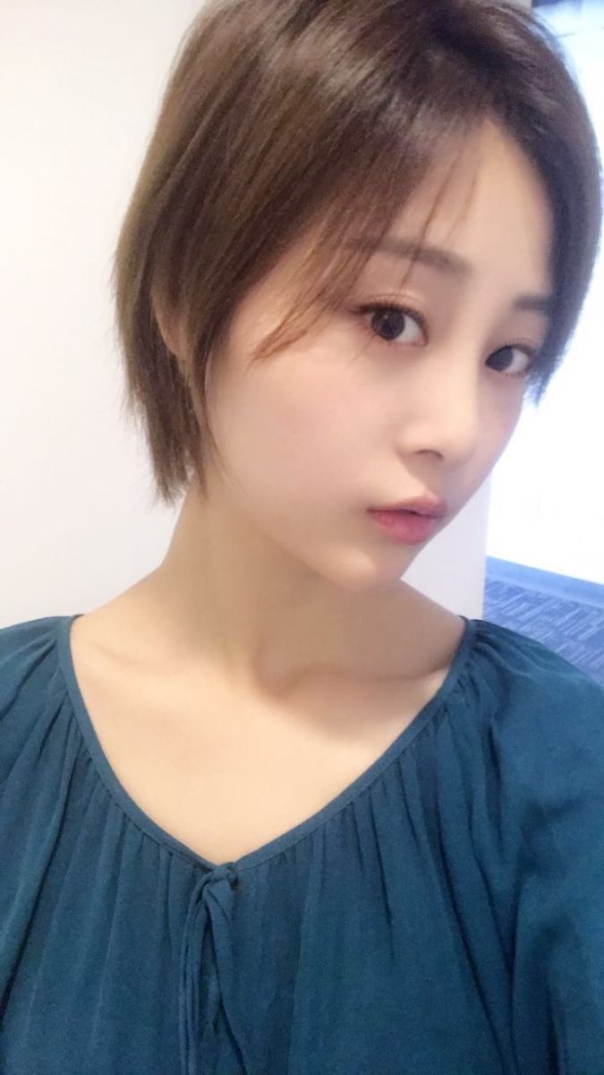 天津歐華威莎整形醫(yī)生姚玲做面部埋線提升效果怎么樣？附埋線提升案例