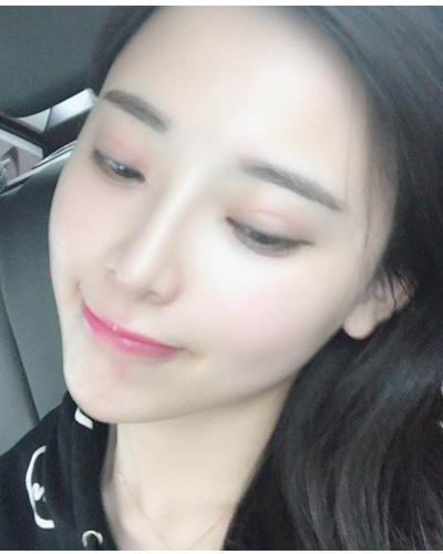 襄陽維多利亞整形醫(yī)院安邰晥醫(yī)生做鼻綜合整形怎么樣？附鼻綜合整形案例