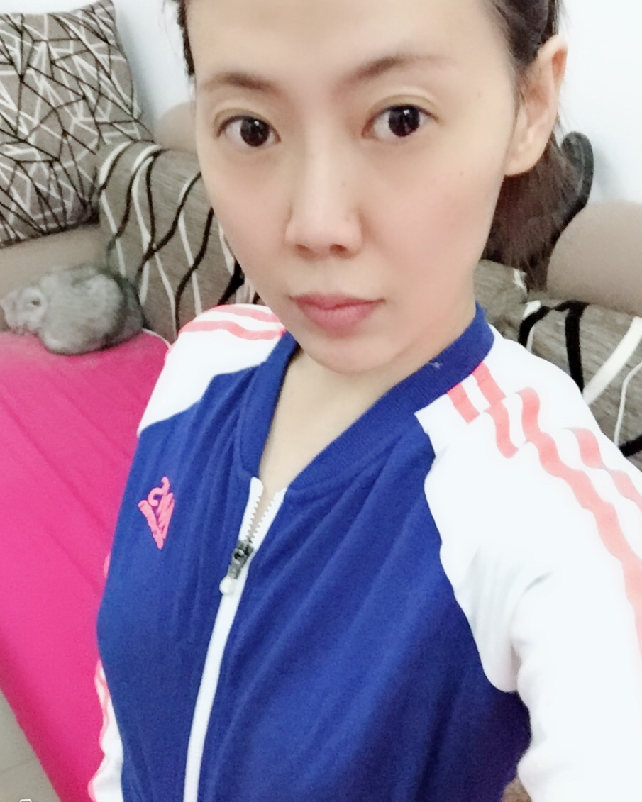 煙臺(tái)壹美整形醫(yī)院朱建瑩醫(yī)生做自體脂肪隆胸怎么樣？附自體脂肪隆胸案例