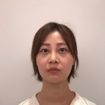 天津歐華威莎整形醫(yī)生姚玲做面部埋線提升效果怎么樣？附埋線提升案例