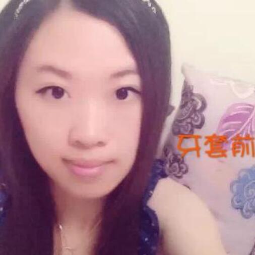 重慶嘉悅口腔醫(yī)院周繼祥醫(yī)生做金屬托槽矯正效果怎么樣？附案例效果對比圖