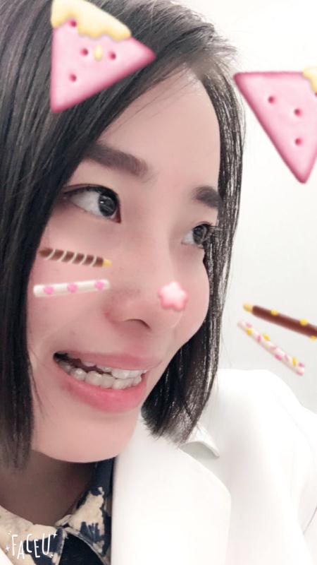 鄭州壹加壹整形醫(yī)院楊永利醫(yī)生做牙齒隱形矯正怎么樣？附牙齒隱形矯正案例