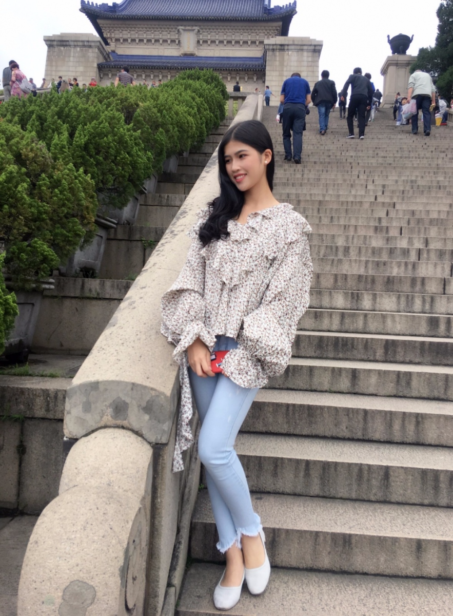 晉城鳳凰整形美容醫(yī)院宋發(fā)興醫(yī)生做大腿吸脂怎么樣？附大腿吸脂案例