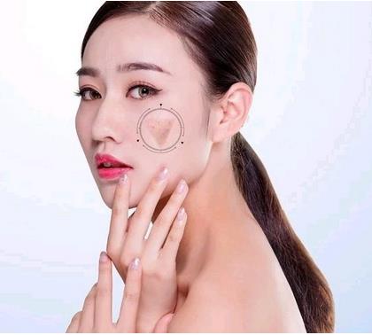 ?？诩t妝尚整形光子嫩膚