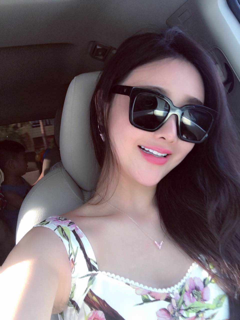 廣州柏德口腔蘭海龍醫(yī)生做瓷貼面效果怎么樣？廣州柏德口腔瓷貼面案例分享