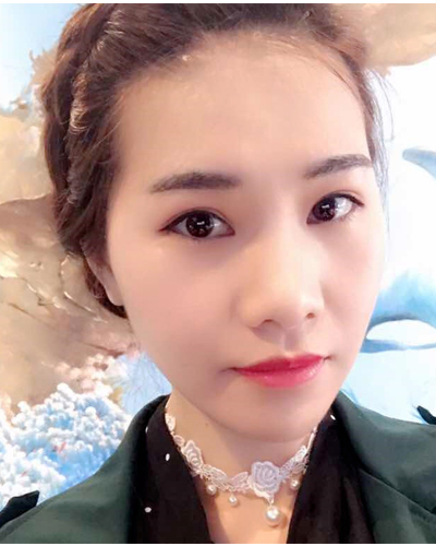 營(yíng)口臻美醫(yī)療整形醫(yī)生閆迎軍做雙眼皮效果怎么樣？附雙眼皮案例對(duì)比圖