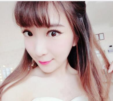 武漢中翰整形外科醫(yī)院陳志鵬醫(yī)生做雙眼皮修復(fù)效果怎么樣？附雙眼皮修復(fù)案例