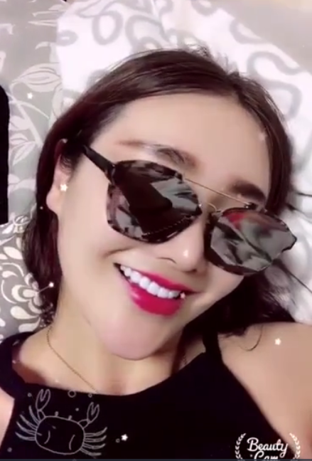 廣州柏德口腔蘭海龍醫(yī)生做瓷貼面效果怎么樣？廣州柏德口腔瓷貼面案例分享