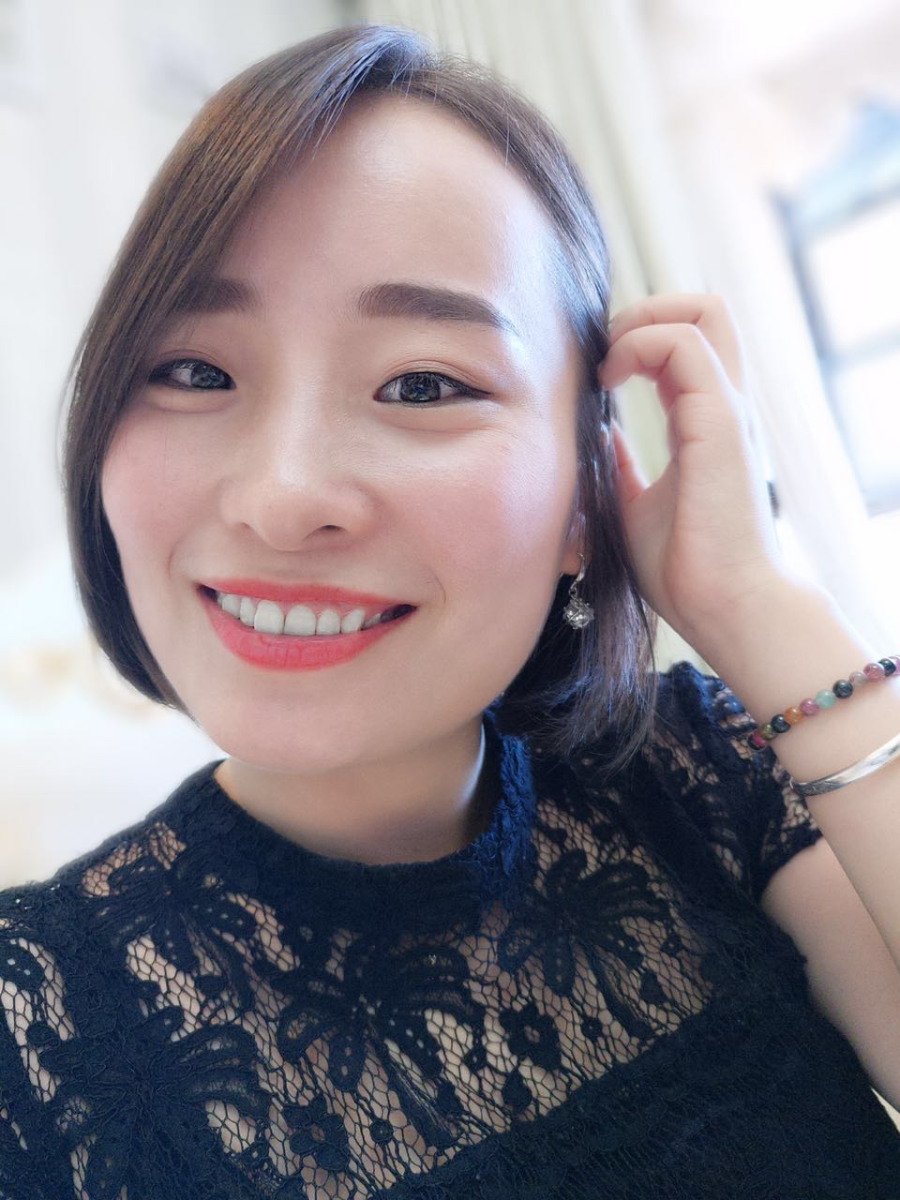 鄭州壹加壹整形醫(yī)院楊永利醫(yī)生做牙齒隱形矯正怎么樣？附牙齒隱形矯正案例