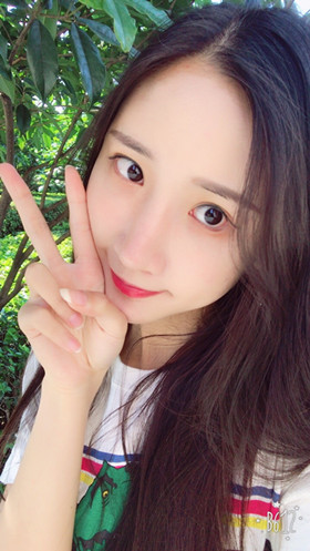 湛江澳泰整形醫(yī)院彭鑫醫(yī)生做自體脂肪豐蘋果肌+太陽穴案例效果對(duì)比圖