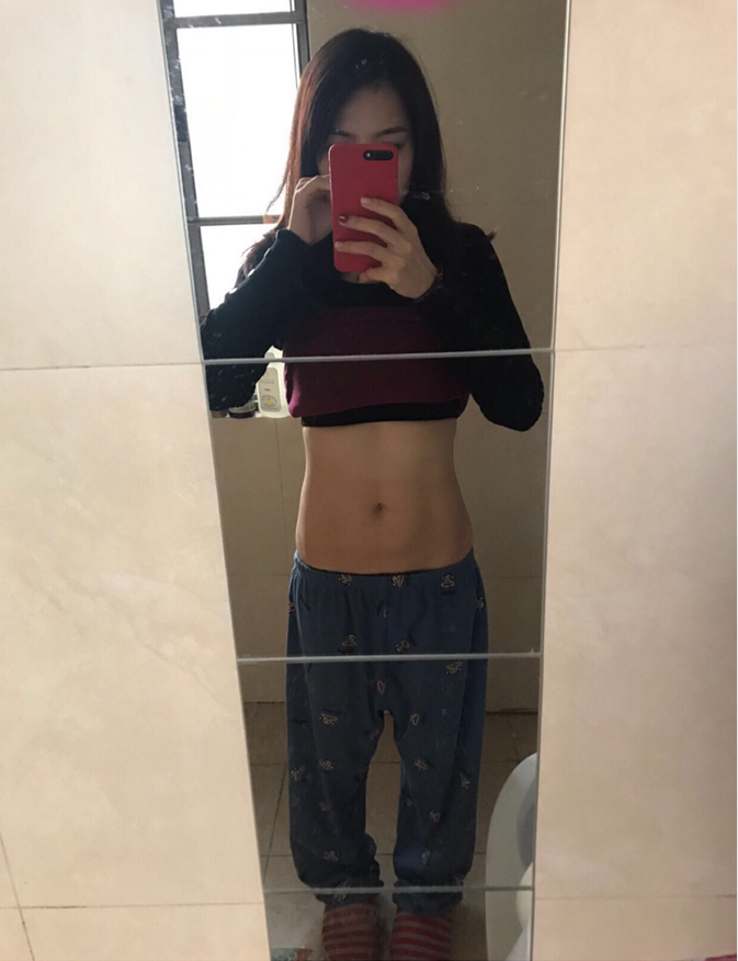 沈陽天使醫(yī)療整形醫(yī)生黃展翼做水動力腰腹吸脂技術(shù)怎么樣？附水動力腰腹吸脂案例