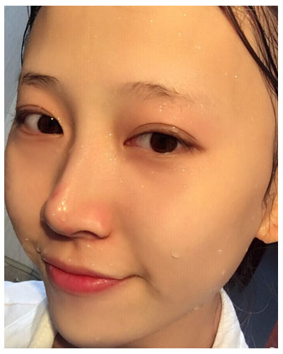 珠海海大整形美容外科黃發(fā)醫(yī)生做面部吸脂怎么樣？附面部吸脂案例