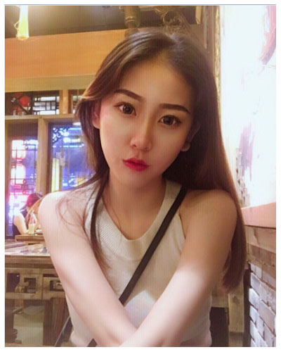 珠海海大整形美容外科黃發(fā)醫(yī)生做面部吸脂怎么樣？附面部吸脂案例