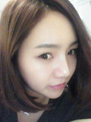 長(zhǎng)春中妍整形醫(yī)院吳學(xué)軍醫(yī)生做玻尿酸墊下巴+玻尿酸豐太陽(yáng)穴案例效果對(duì)比圖 長(zhǎng)春中妍整形醫(yī)院吳學(xué)軍醫(yī)生做玻尿酸墊下巴+玻尿酸豐太陽(yáng)穴案例效果對(duì)比圖