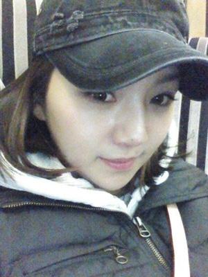 長(zhǎng)春中妍整形醫(yī)院吳學(xué)軍醫(yī)生做玻尿酸墊下巴+玻尿酸豐太陽(yáng)穴案例效果對(duì)比圖 長(zhǎng)春中妍整形醫(yī)院吳學(xué)軍醫(yī)生做玻尿酸墊下巴+玻尿酸豐太陽(yáng)穴案例效果對(duì)比圖