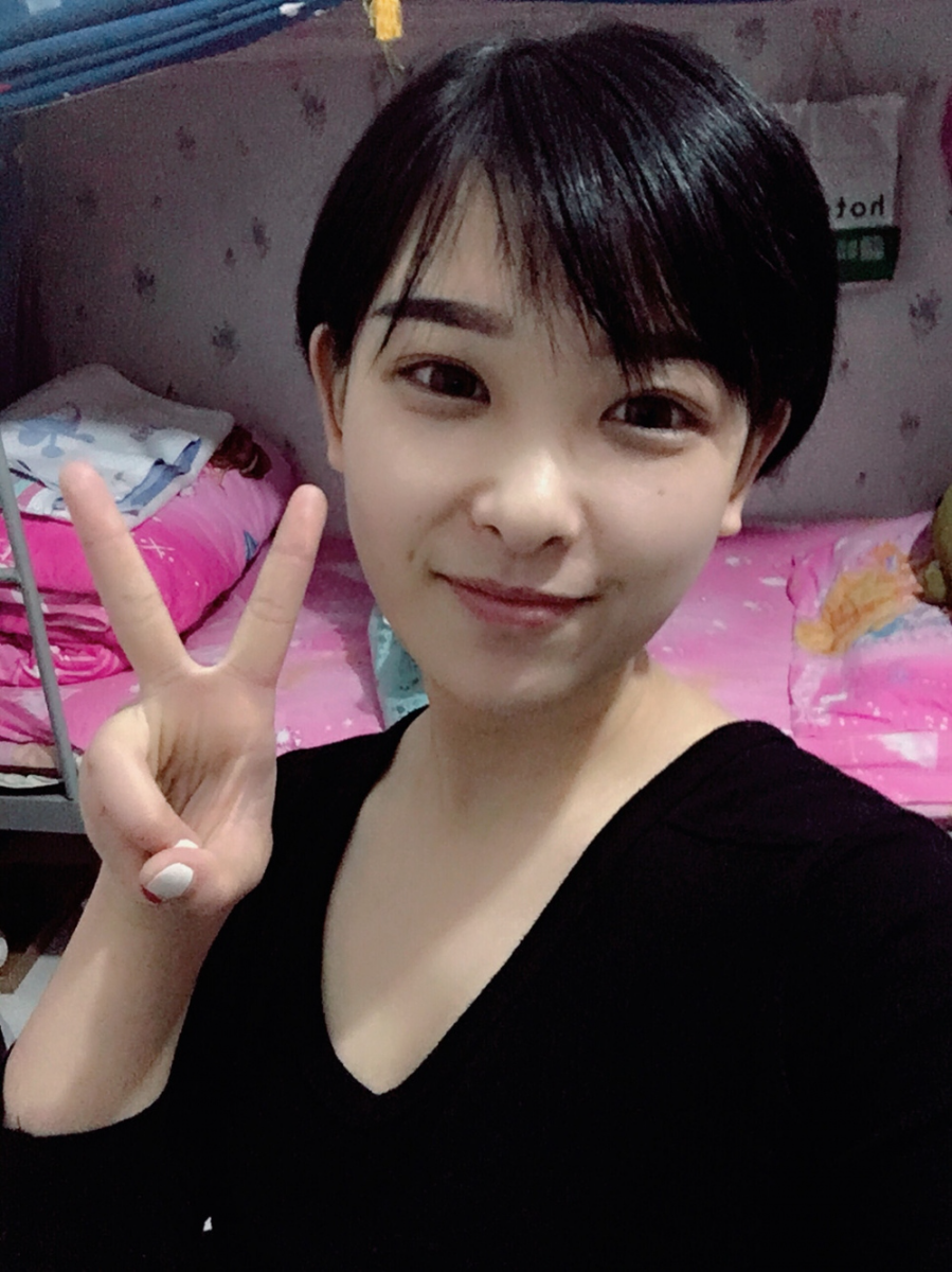 武漢肽慕醫(yī)美整形醫(yī)院楊婉菱醫(yī)生做面部吸脂效果怎么樣？附面部吸脂案例