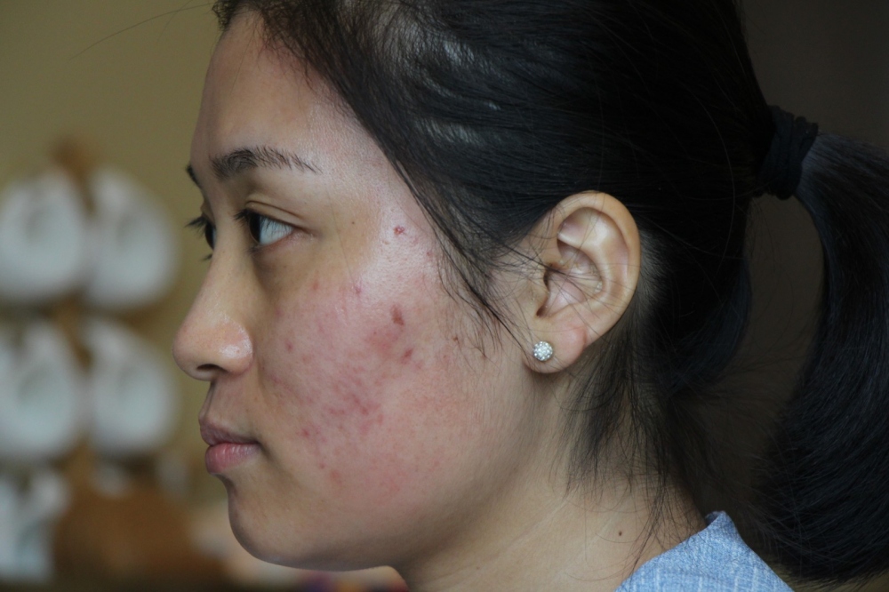 1518403501820978.jpg 1518403501820978.jpg