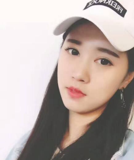 北京亞奧整形醫(yī)生程金龍做韓式三點雙眼皮+開內(nèi)眼角效果怎么樣？