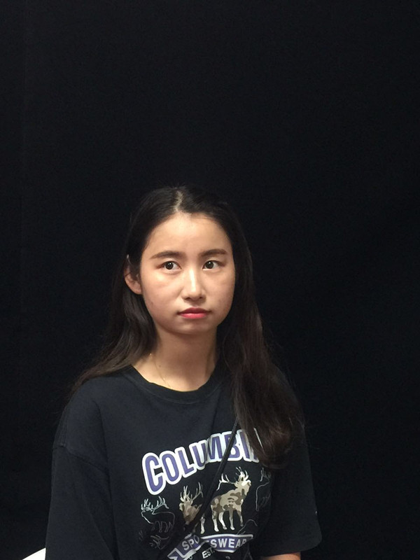 西安高一生整形醫(yī)院何志洪做埋線提升效果怎么樣？附埋線提升案例