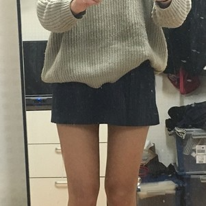 株洲雅美醫(yī)療整形醫(yī)生車旺做大腿吸脂效果怎么樣？附案例效果對(duì)比圖