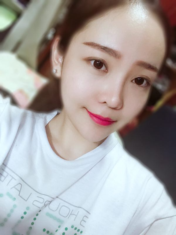 北京可思美醫(yī)療整形醫(yī)生蘇靜做臉部自體脂肪填充效果怎么樣？