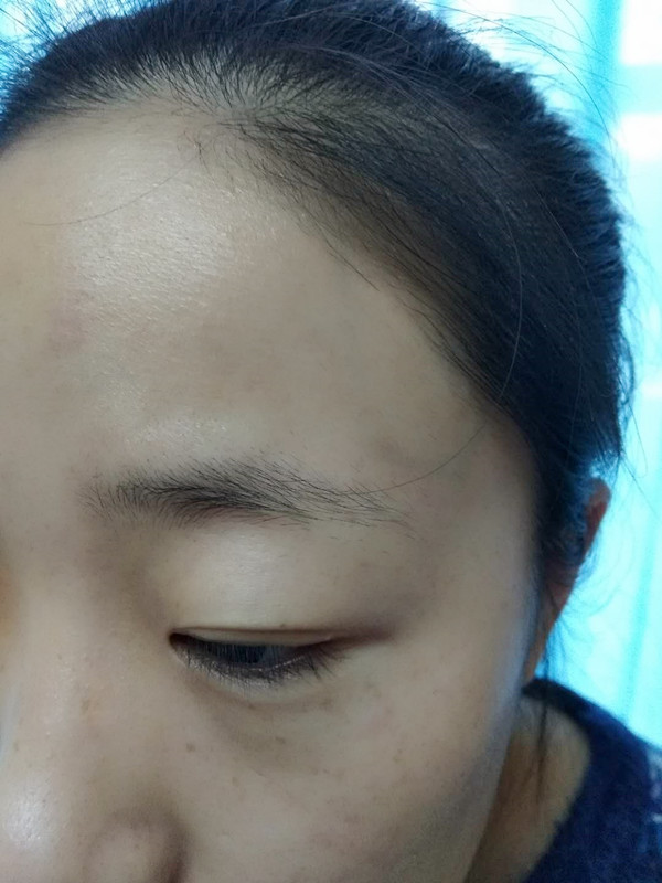 長沙愛思特醫(yī)療美容醫(yī)院做半永久紋眉怎么樣？附彭子娟醫(yī)生案例效果圖